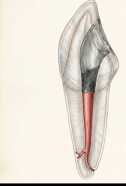 La dentine a retrouvé sa teinte